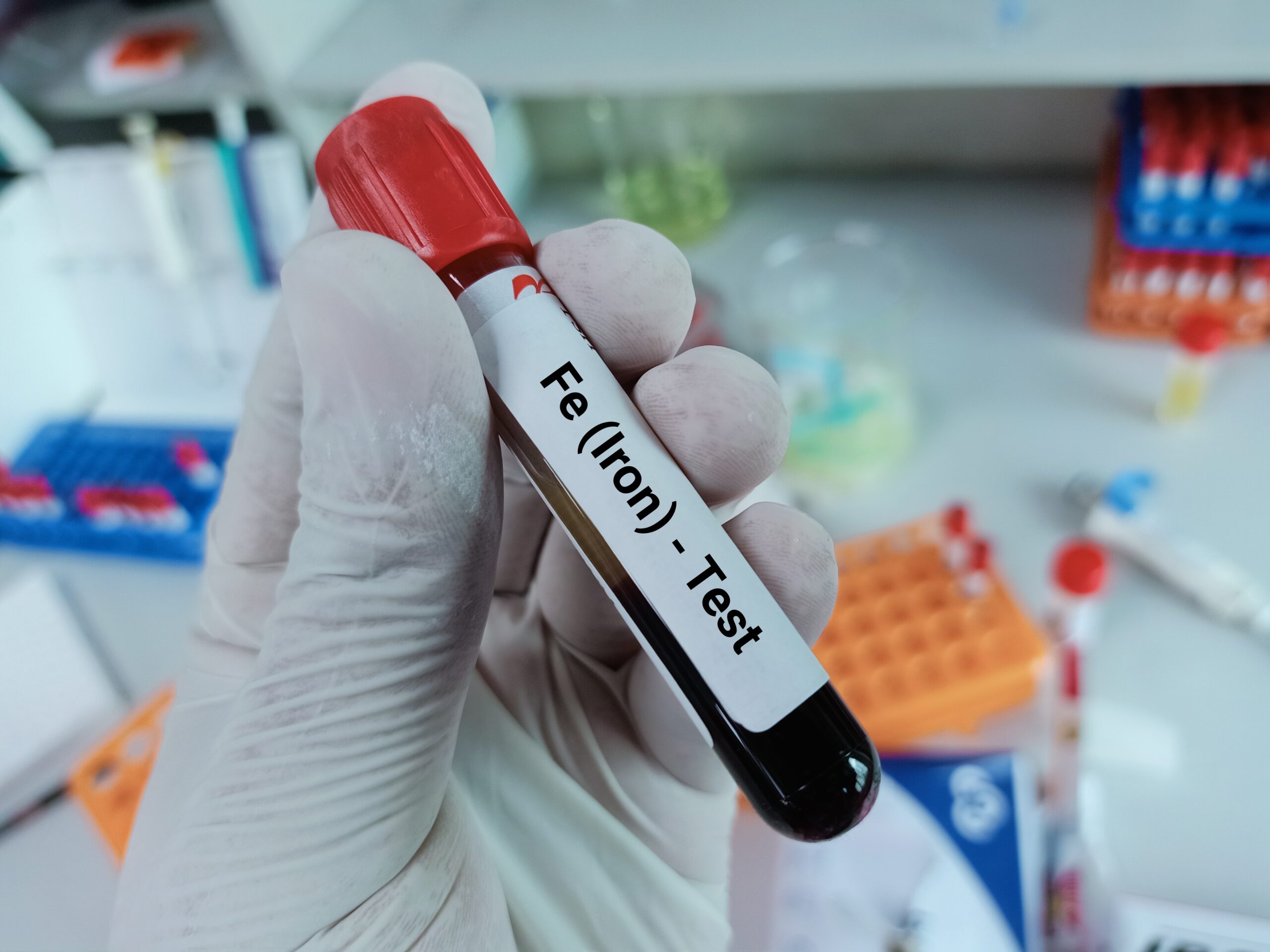 test iron blood test