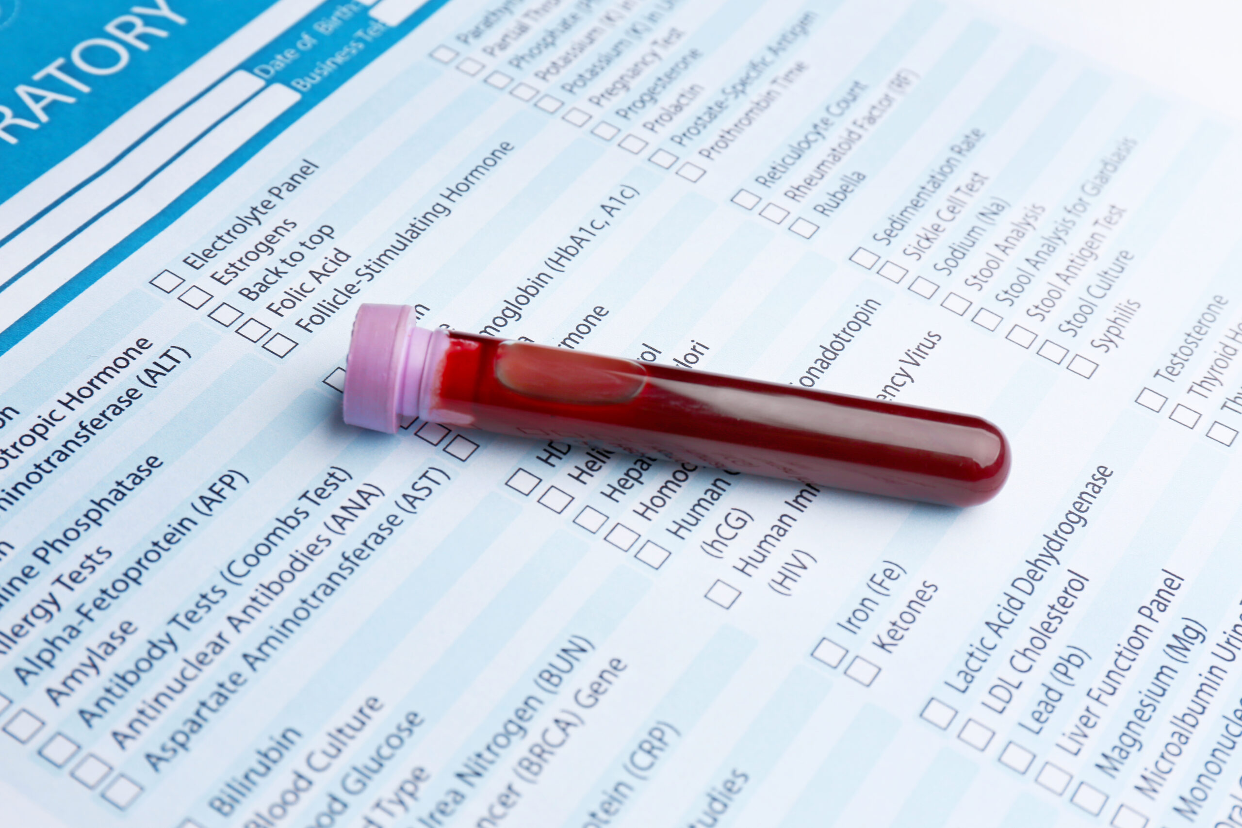 Full blood count TESTS