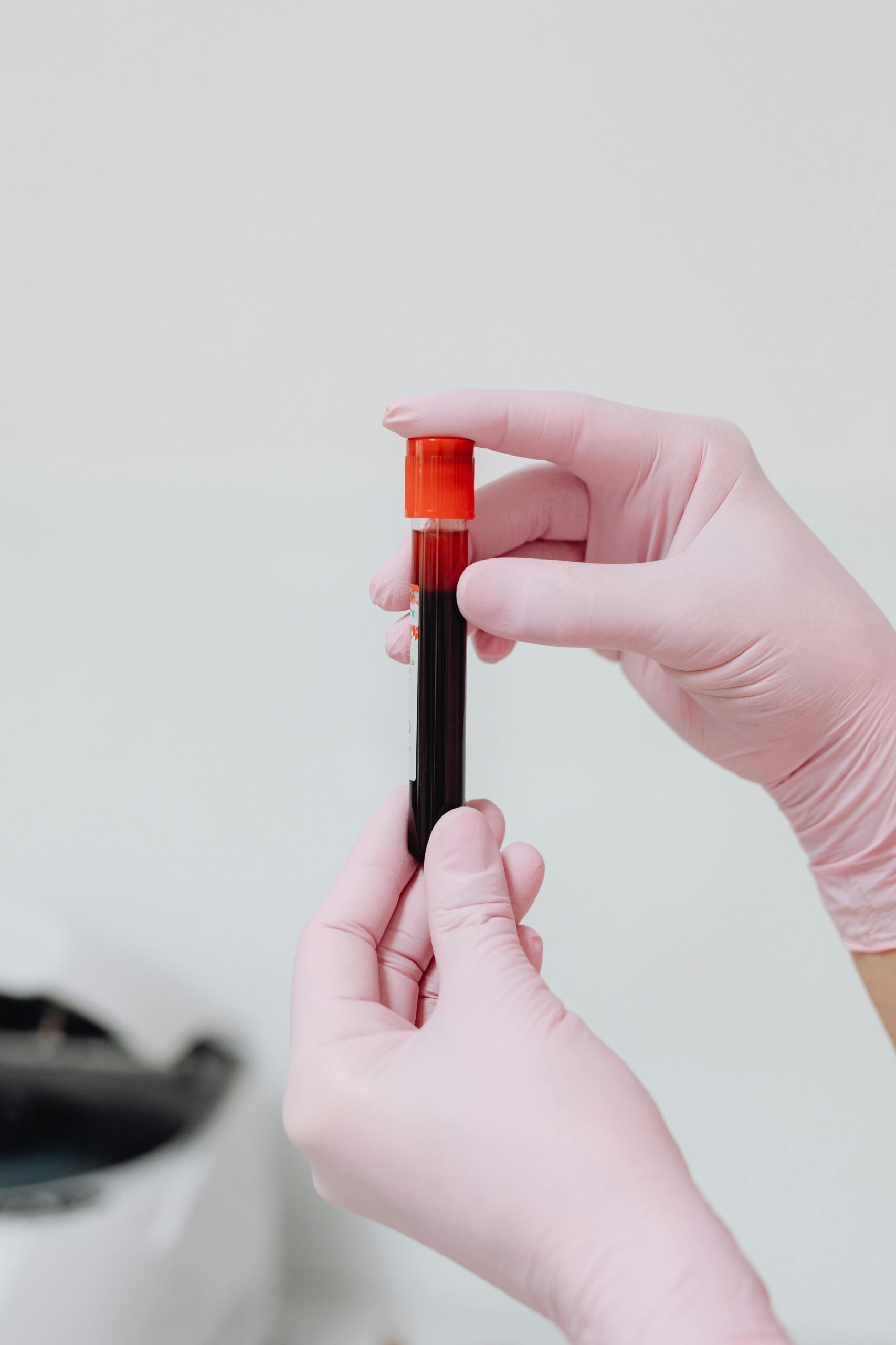 blood sample