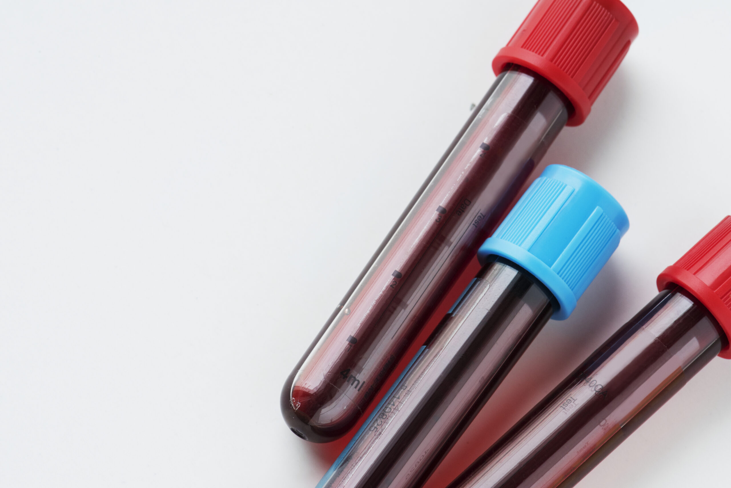 blood test